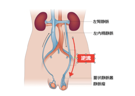 大精嚢 